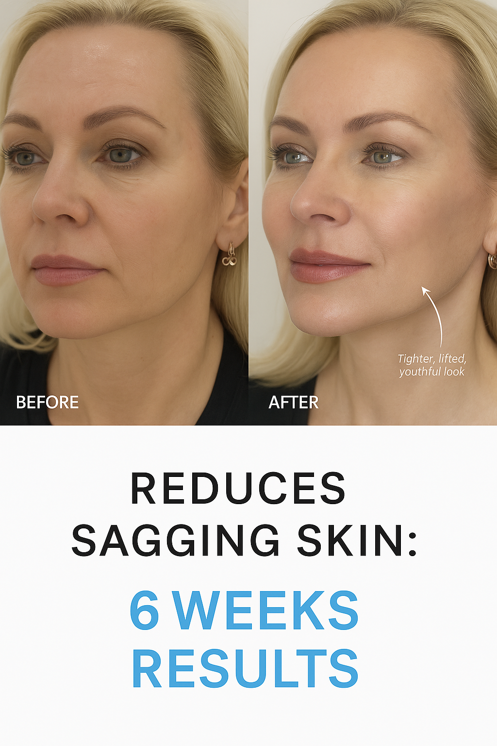 SkinAura